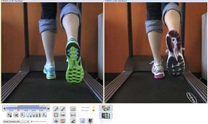 Video gait Analysis